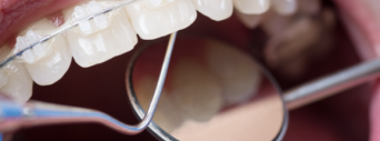 Sorriso saudável para mais brasileiros
